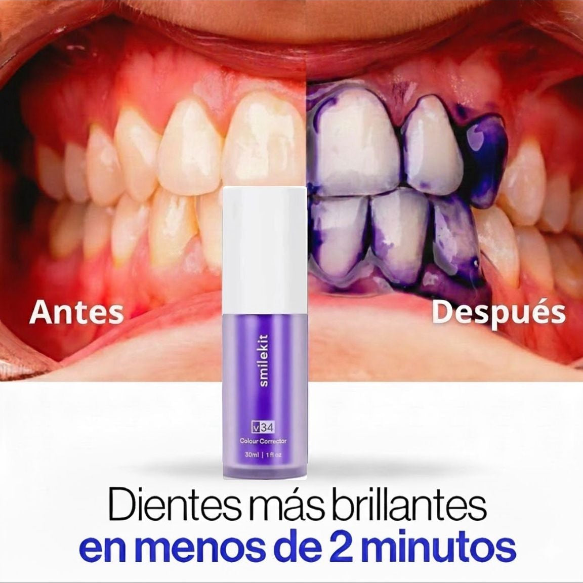 Serum Blanqueador Instantáneo - UltraWhiteV34
